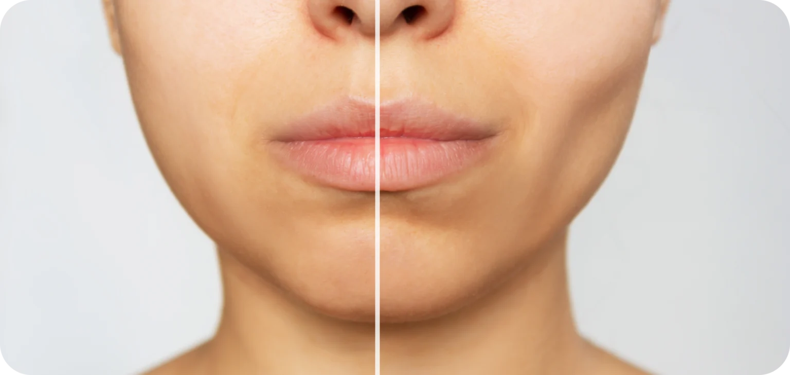 chirurgie-esthetique-visage-cabinet MB